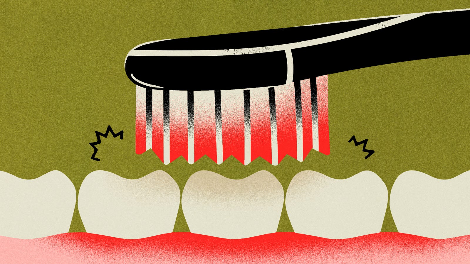How to Know If You’re Brushing Your Teeth Too Hard